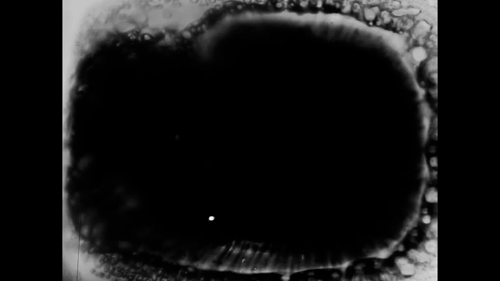 History of a dying eye