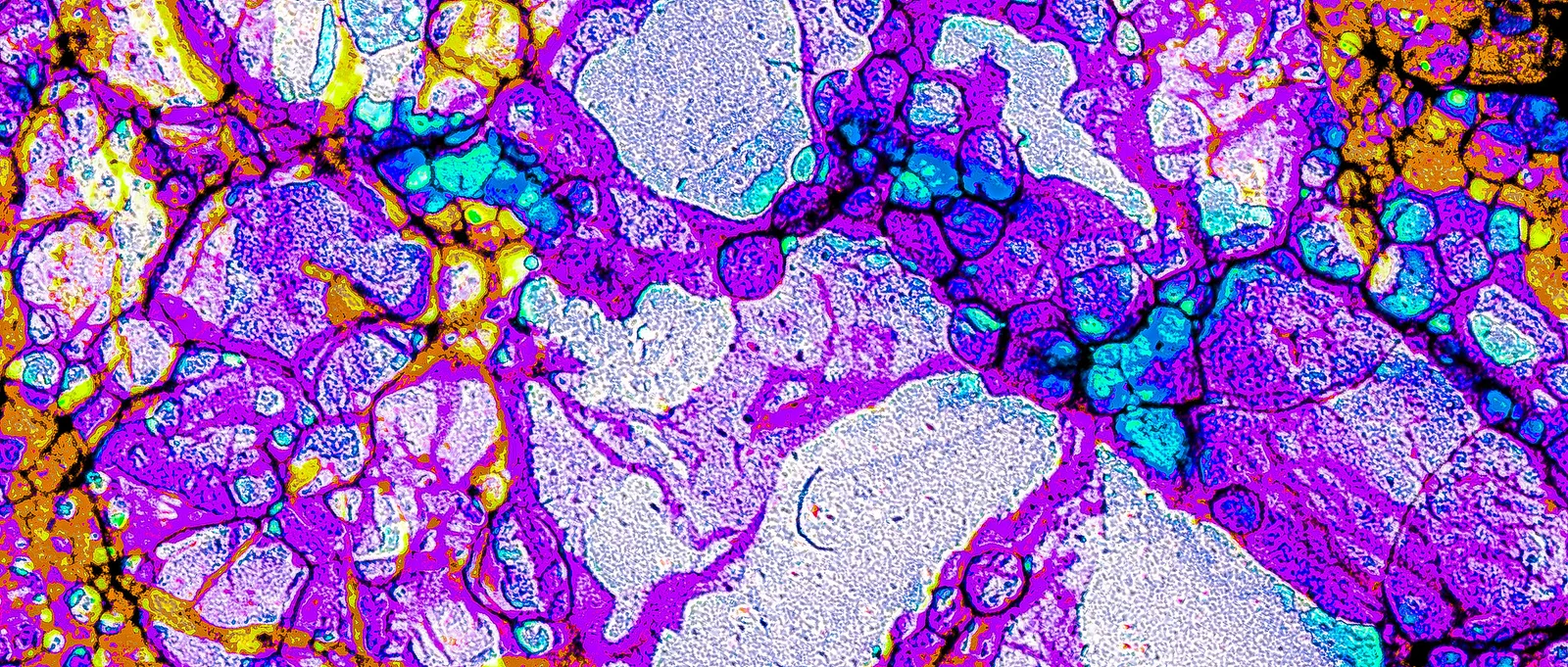 Embers from Yesterday, Aflame.