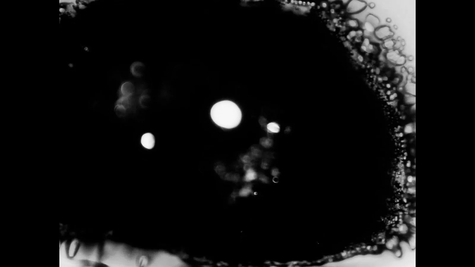 History of a dying eye