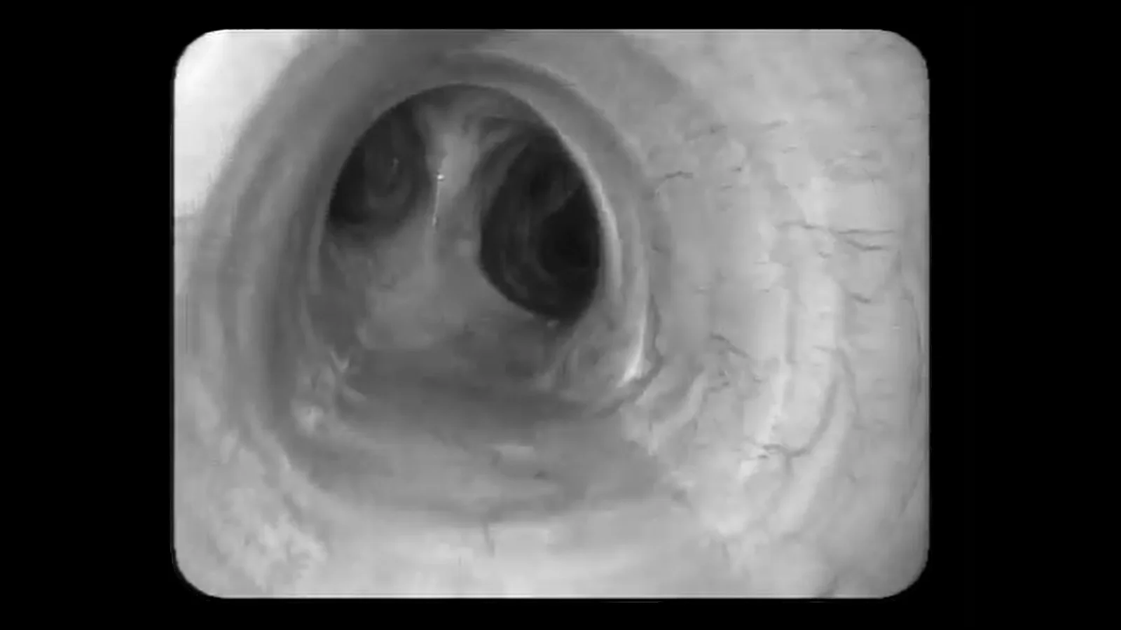 TERRIFYING HOLES COMPILATION