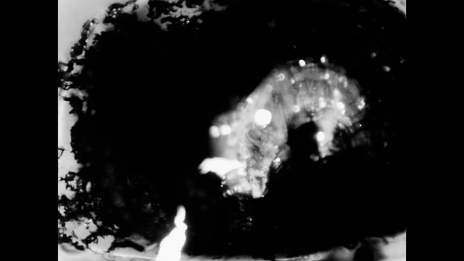 History of a dying eye