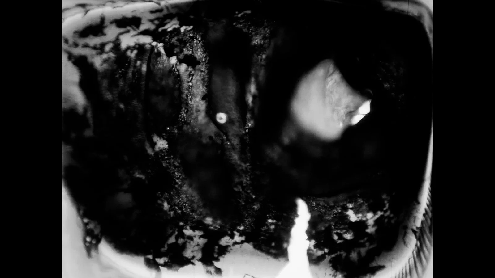 History of a dying eye